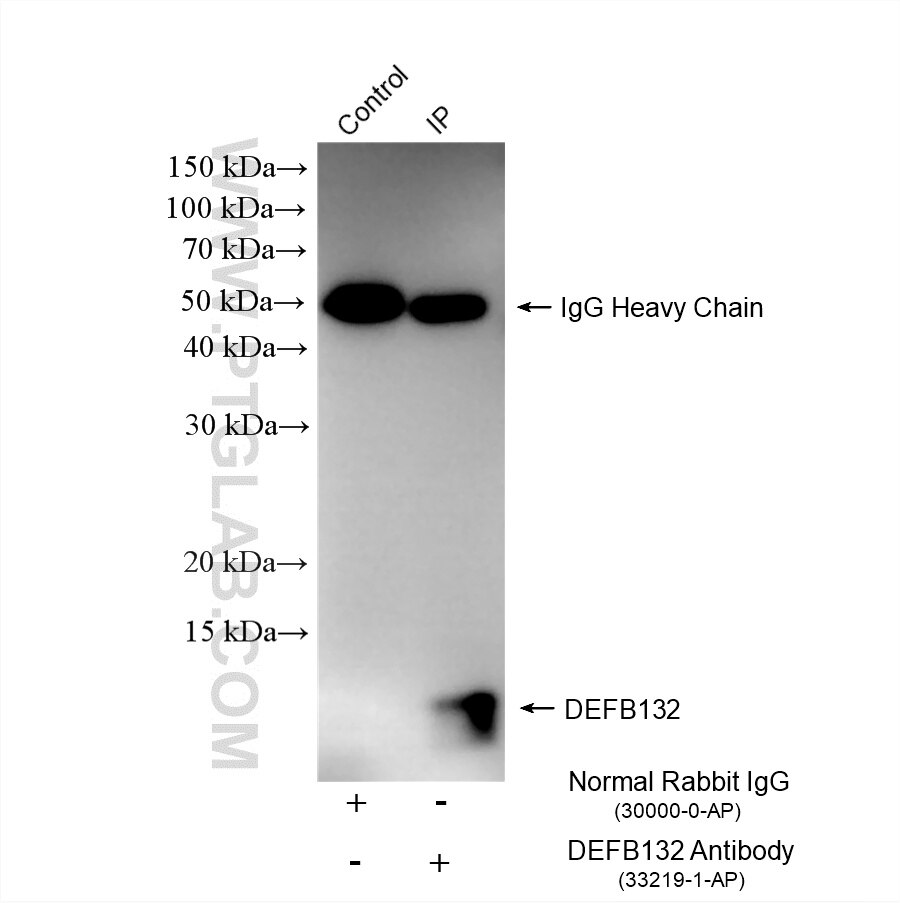 IP experiment of LNCaP using 33219-1-AP Immunoprecipitation (IP) experiment of LNCaP cells using DEFB132 Polyclonal antibody (33219-1-AP)