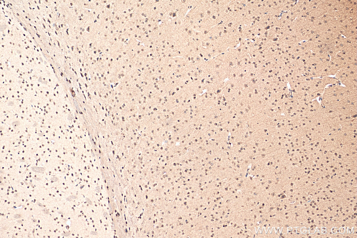 Immunohistochemistry (IHC) staining of mouse brain tissue using DEK Polyclonal antibody (16448-1-AP)