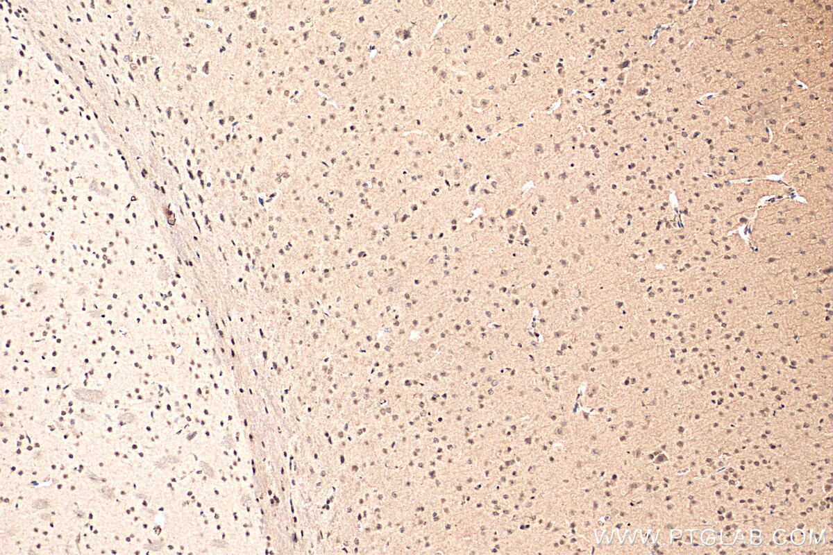 IHC staining of mouse brain using 16448-1-AP