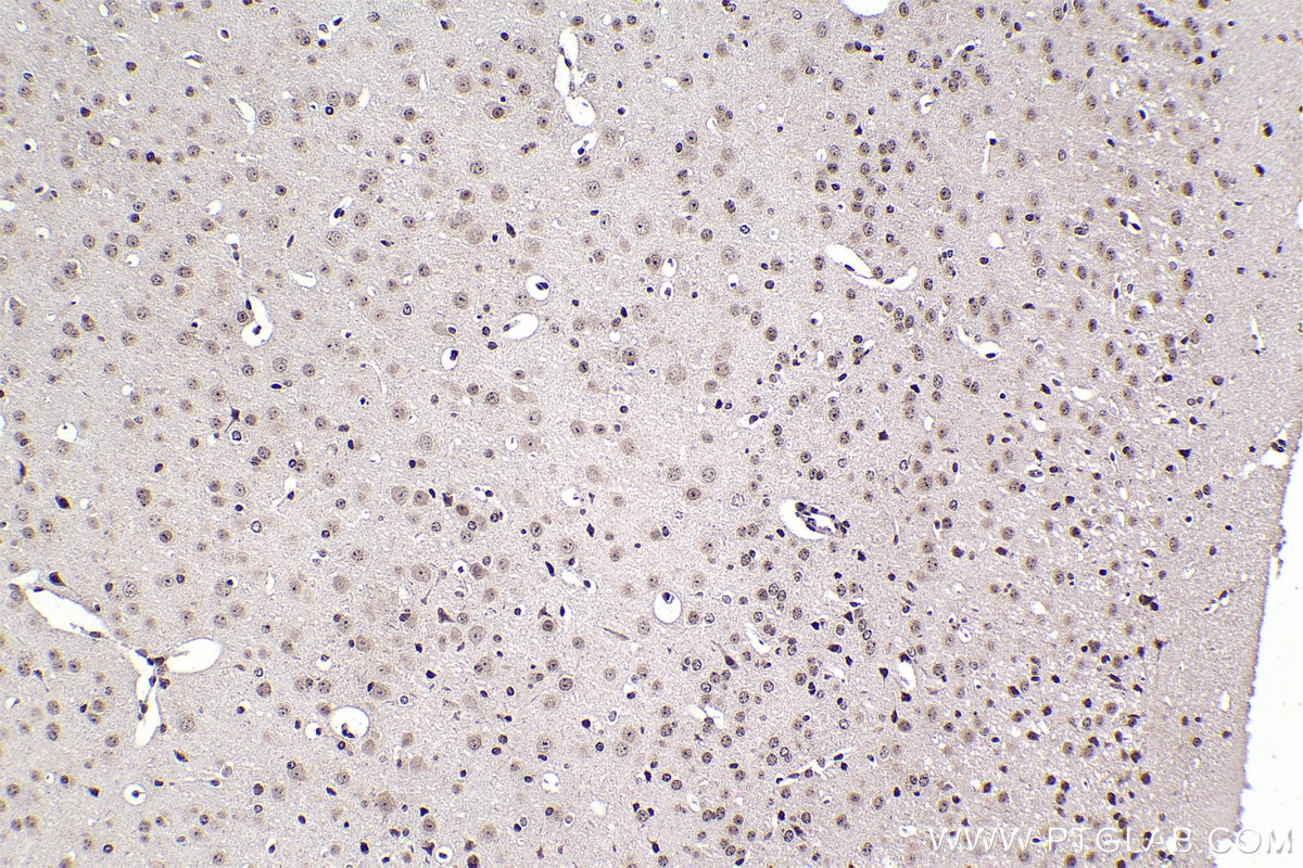 Immunohistochemistry (IHC) staining of mouse brain tissue using DEK Polyclonal antibody (16448-1-AP)