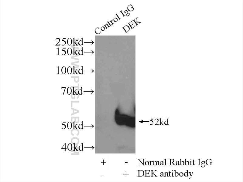 Immunoprecipitation (IP) experiment of HeLa cells using DEK Polyclonal antibody (16448-1-AP)