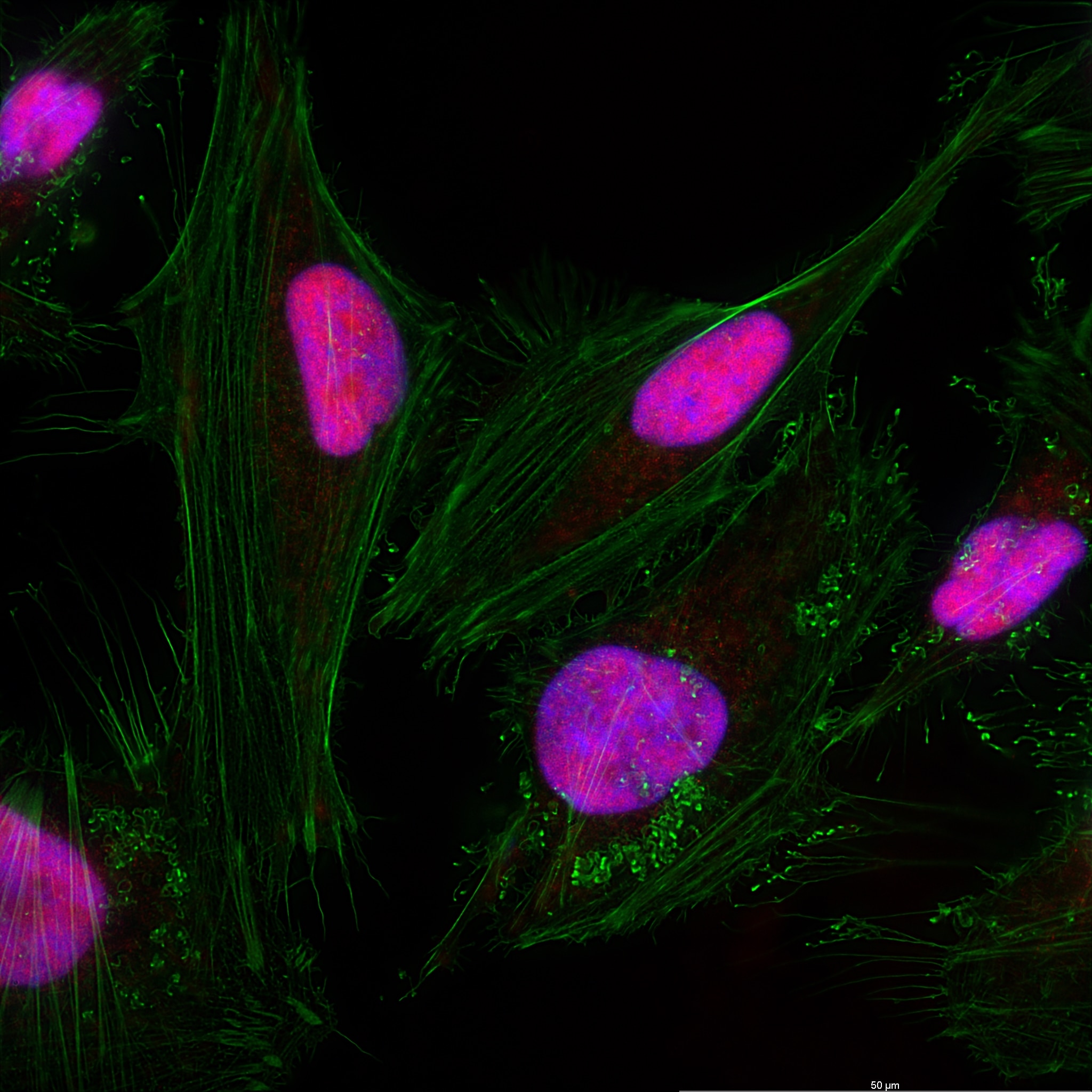 Immunofluorescence (IF) / fluorescent staining of HeLa cells using DEK Recombinant antibody (82880-1-RR)