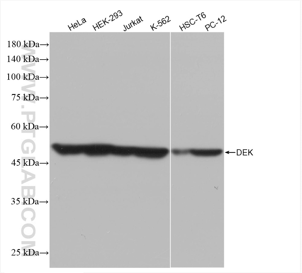 Western Blot (WB) analysis of various lysates using DEK Recombinant antibody (82880-1-RR)