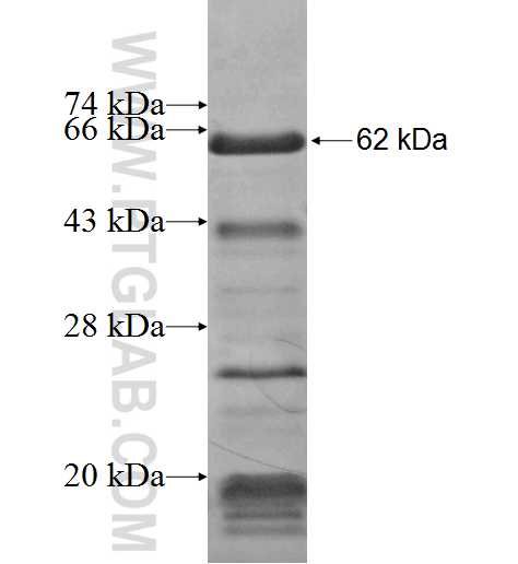 DEK fusion protein Ag8225 SDS-PAGE
