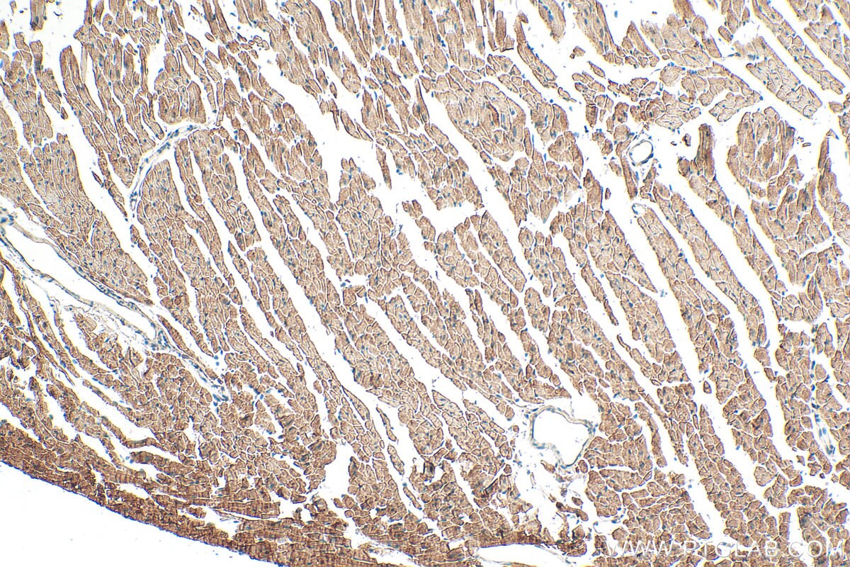 Immunohistochemistry (IHC) staining of mouse heart tissue using DEM1/EXO5 Polyclonal antibody (25991-1-AP)