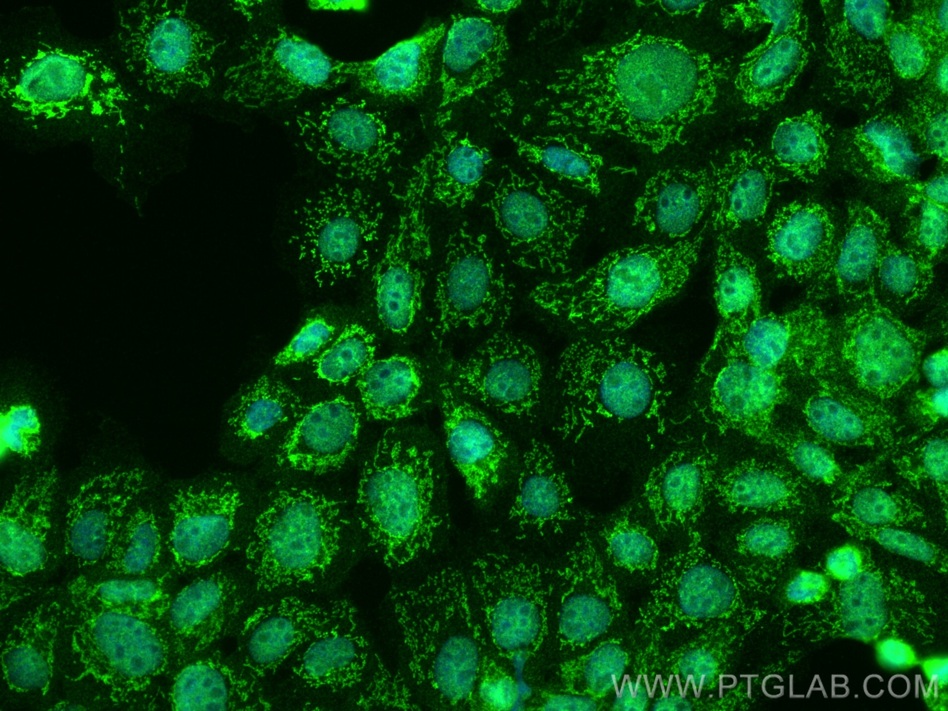 Immunofluorescence (IF) / fluorescent staining of A431 cells using DENND1A Polyclonal antibody (25658-1-AP)