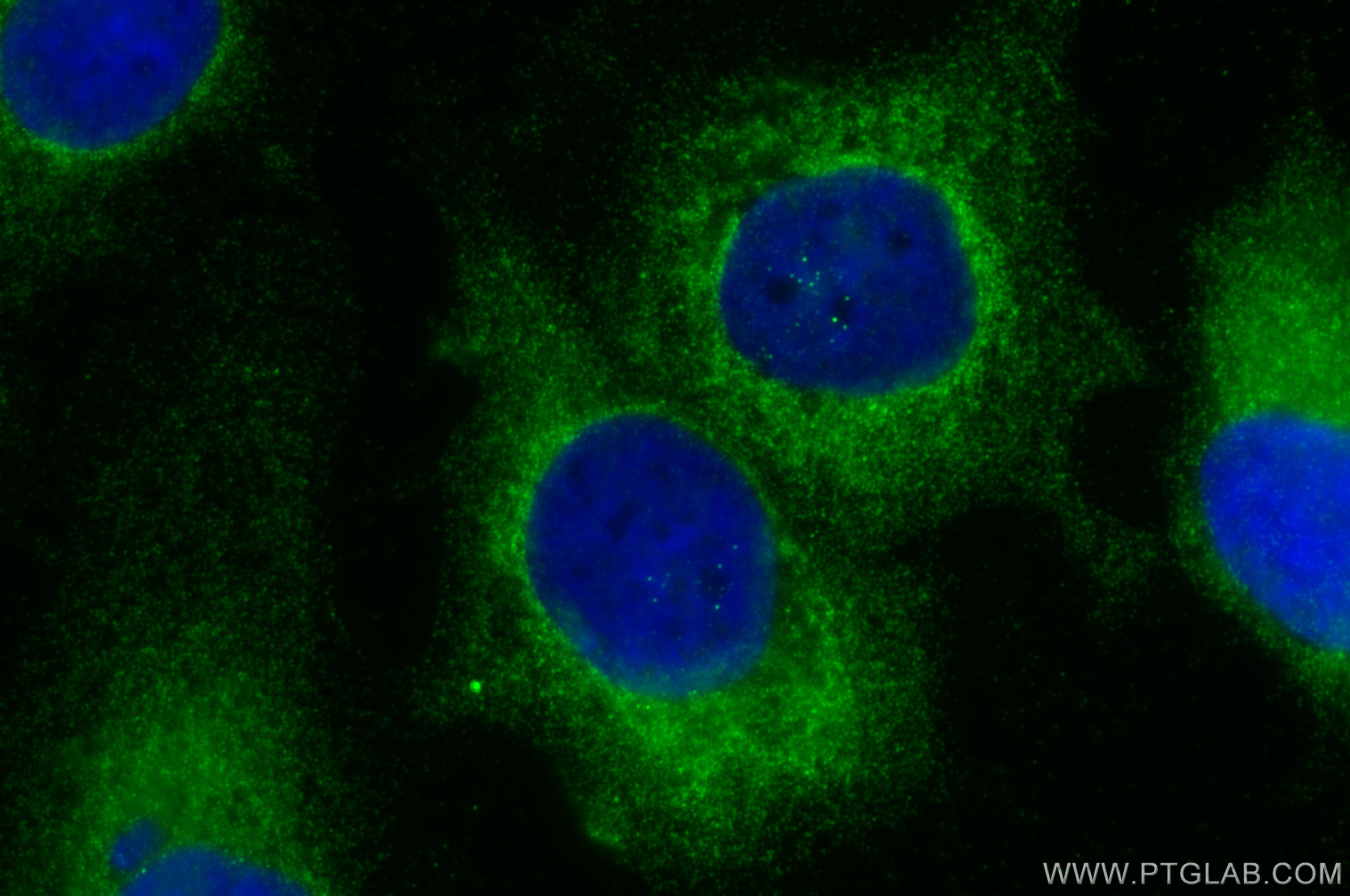 Immunofluorescence (IF) / fluorescent staining of SKOV-3 cells using DENND1A Polyclonal antibody (25658-1-AP)