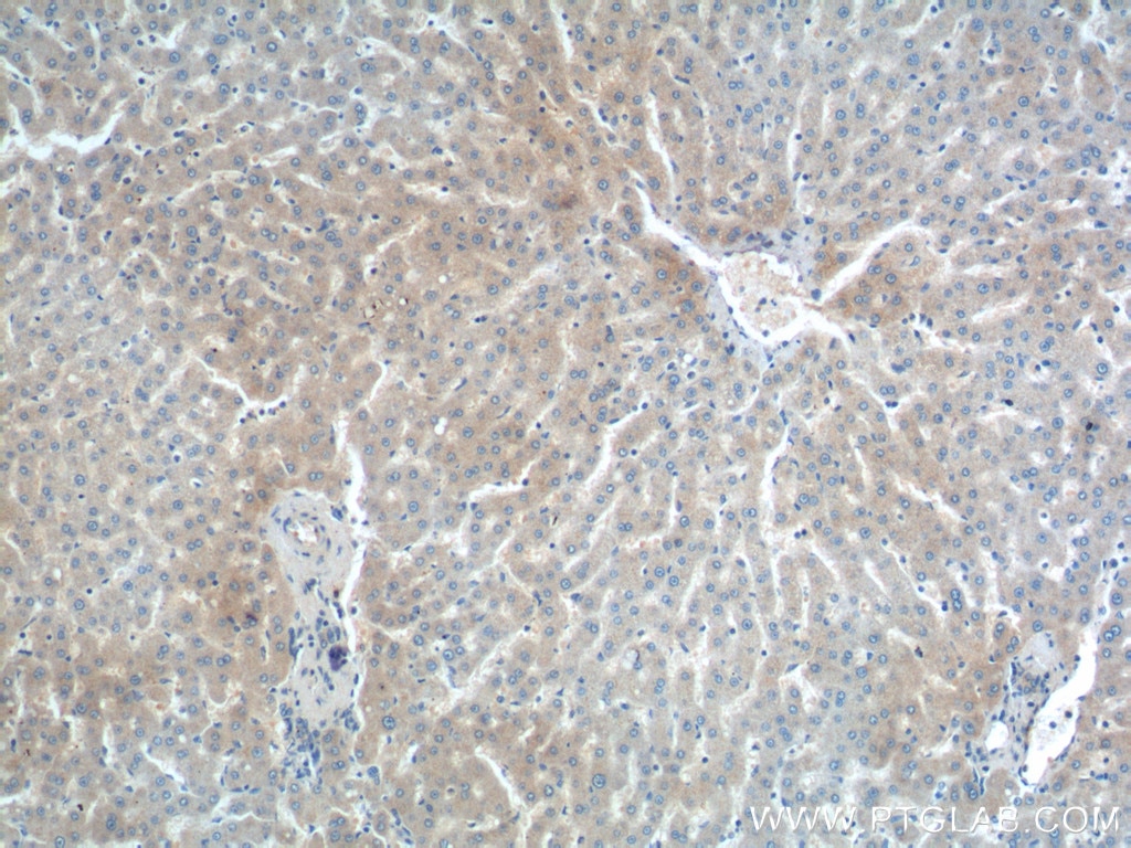 Immunohistochemistry (IHC) staining of human liver tissue using DENND1A Polyclonal antibody (25658-1-AP)