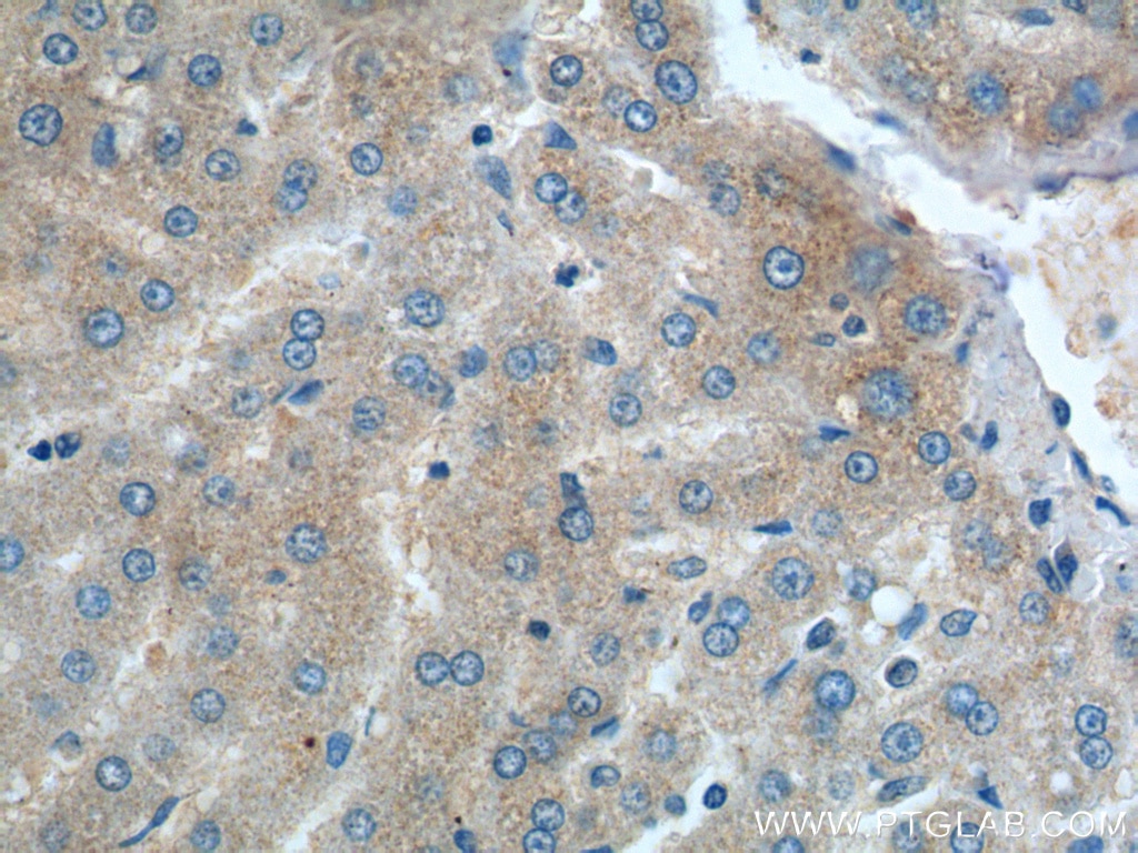 Immunohistochemistry (IHC) staining of human liver tissue using DENND1A Polyclonal antibody (25658-1-AP)
