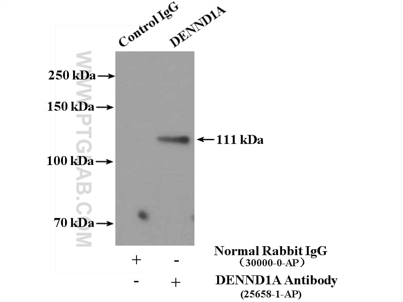 Immunoprecipitation (IP) experiment of K-562 cells using DENND1A Polyclonal antibody (25658-1-AP)
