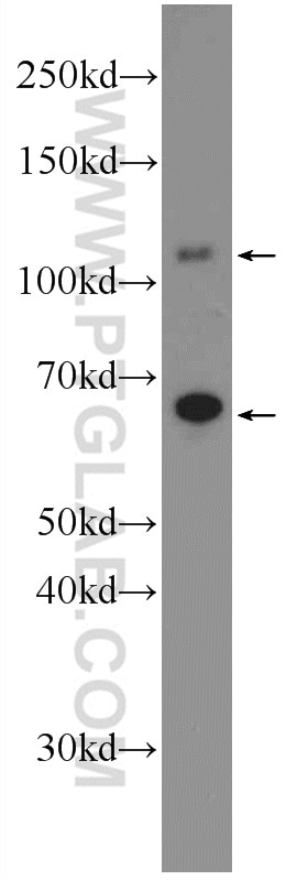 Western Blot (WB) analysis of K-562 cells using DENND1A Polyclonal antibody (25658-1-AP)