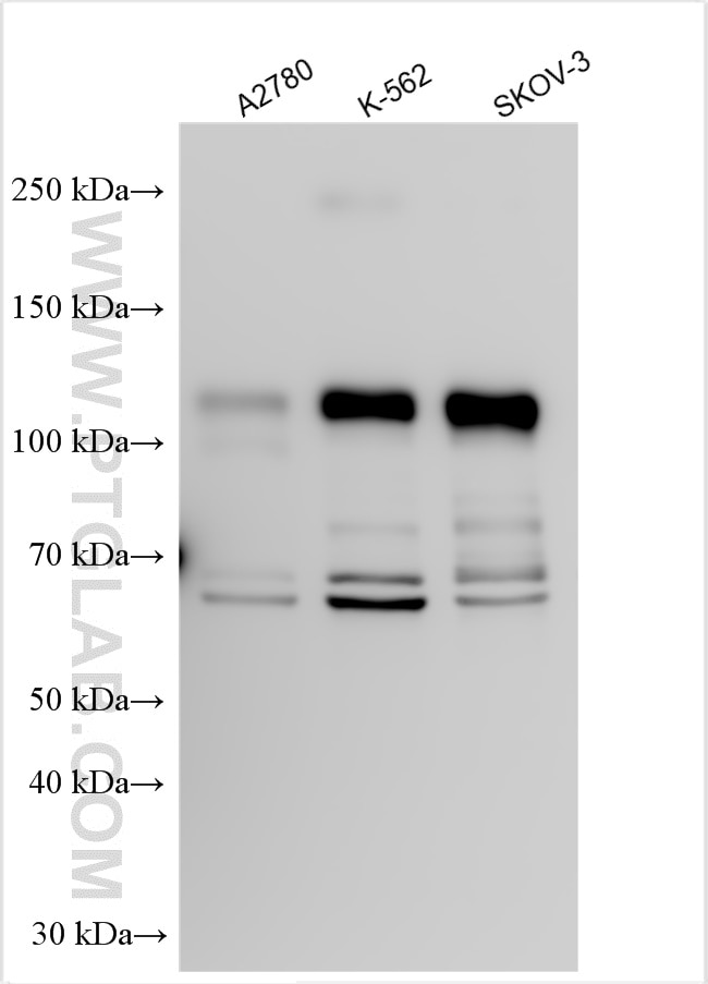 Western Blot (WB) analysis of various lysates using DENND1A Polyclonal antibody (25658-1-AP)