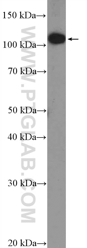 Western Blot (WB) analysis of SKOV-3 cells using DENND1A Polyclonal antibody (25658-1-AP)