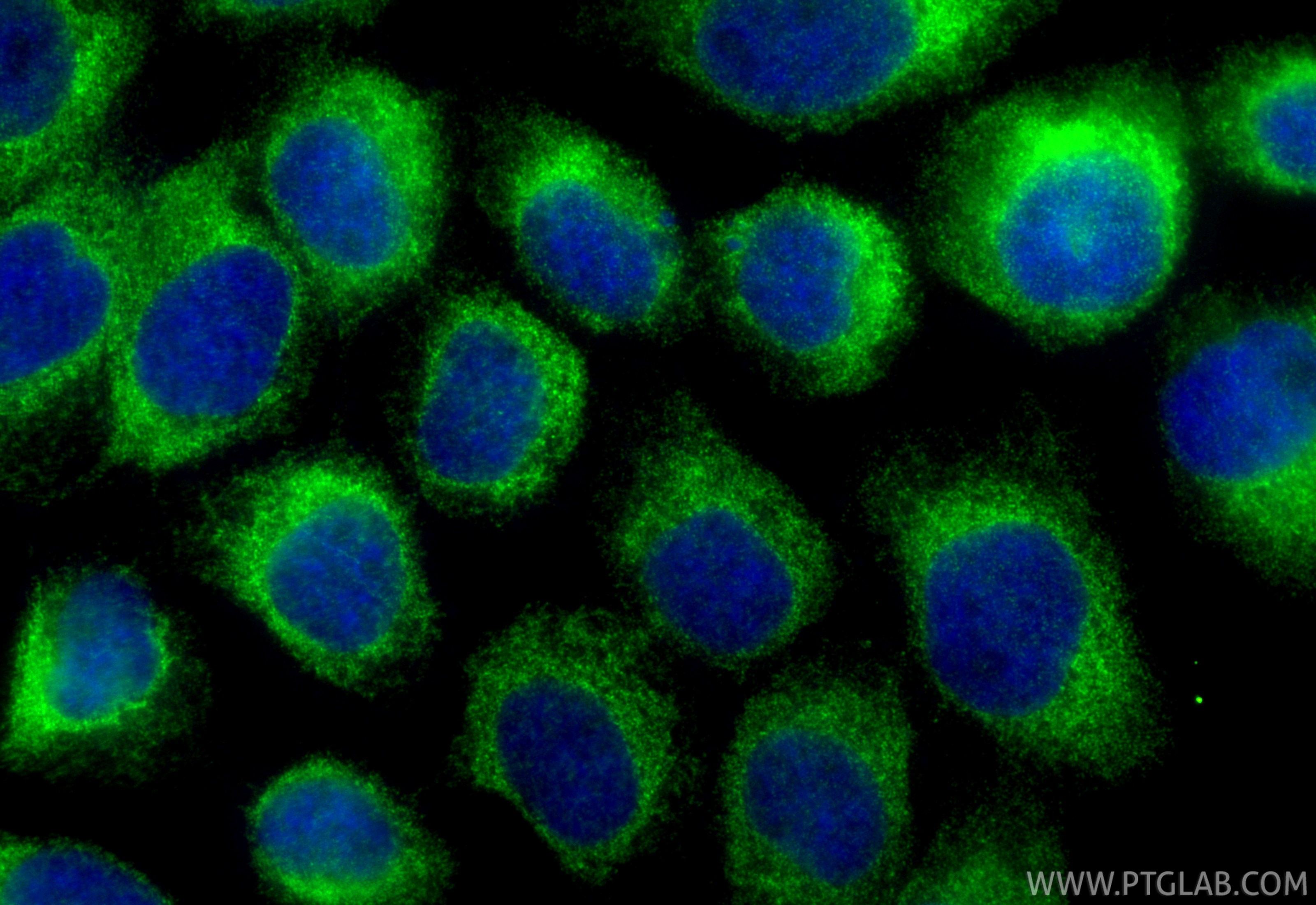 Immunofluorescence (IF) / fluorescent staining of A431 cells using DENND2D Polyclonal antibody (33113-1-AP)