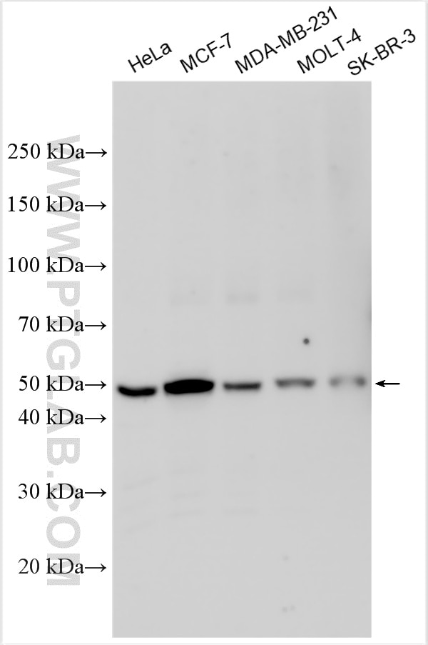 Western Blot (WB) analysis of various lysates using DENND2D Polyclonal antibody (33113-1-AP)