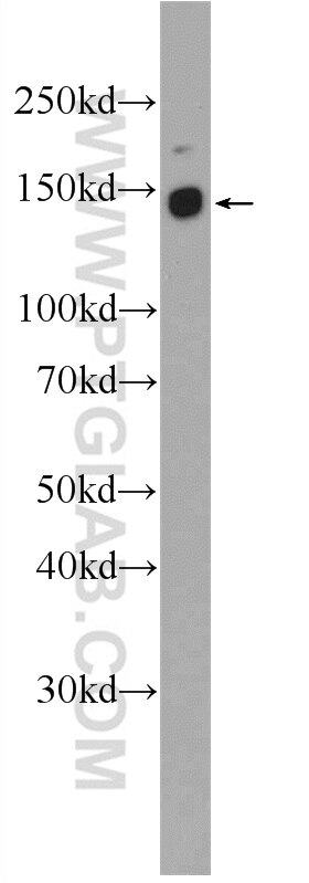 Western Blot (WB) analysis of mouse stomach tissue using DENND3 Polyclonal antibody (24414-1-AP)