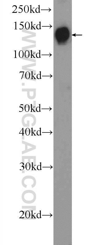 Western Blot (WB) analysis of mouse stomach tissue using DENND3 Polyclonal antibody (24414-1-AP)