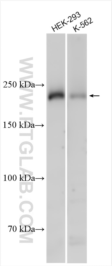Western Blot (WB) analysis of various lysates using DENND4A Polyclonal antibody (26659-1-AP)