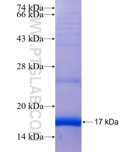 DENND5A fusion protein Ag25184 SDS-PAGE