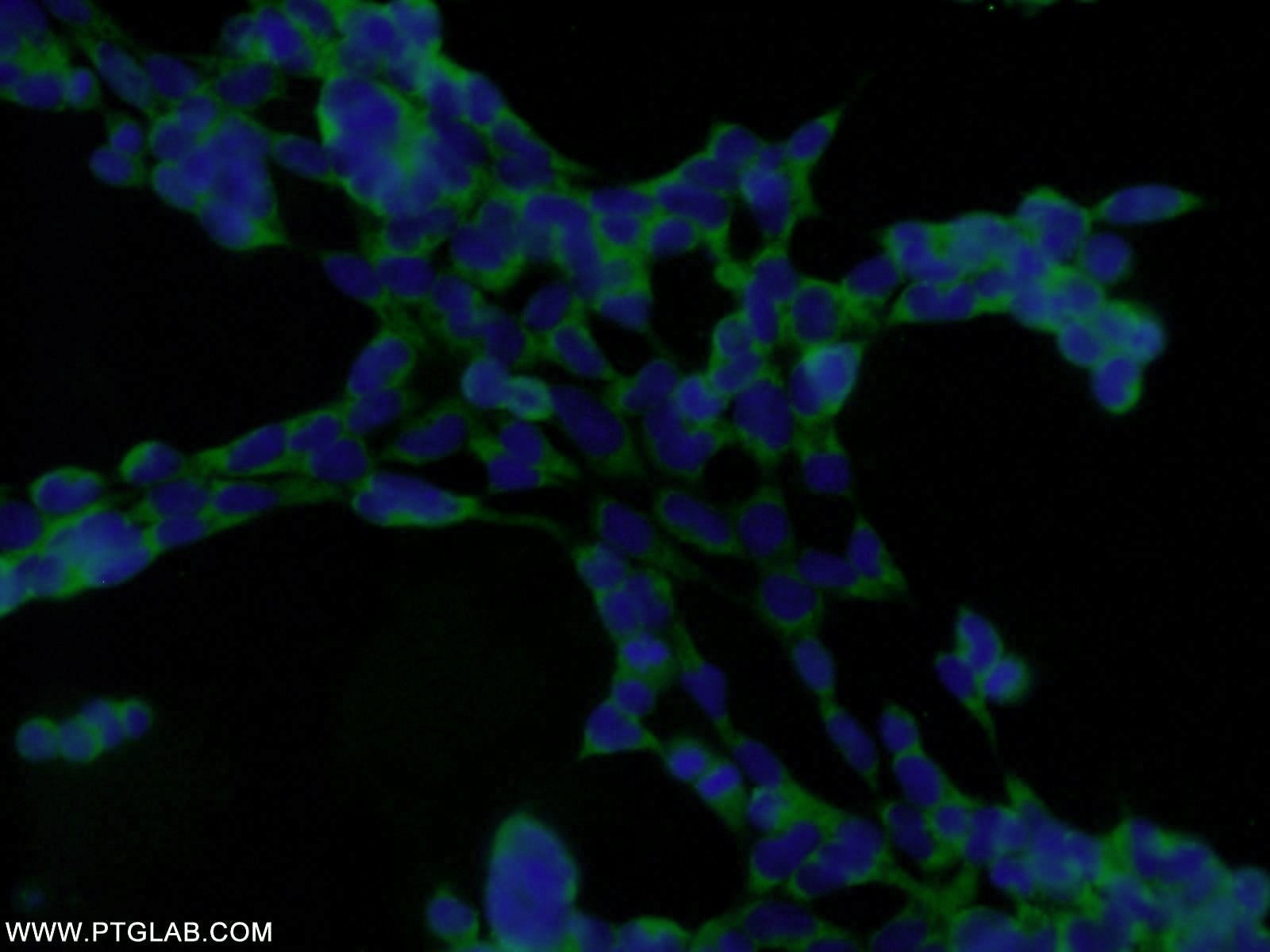 Immunofluorescence (IF) / fluorescent staining of HEK-293 cells using DENR Polyclonal antibody (10656-1-AP)