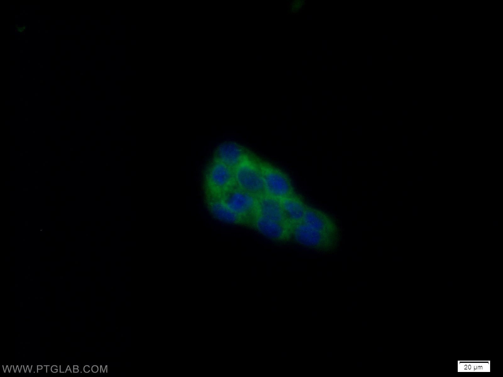 Immunofluorescence (IF) / fluorescent staining of A431 cells using DENR Polyclonal antibody (10656-1-AP)