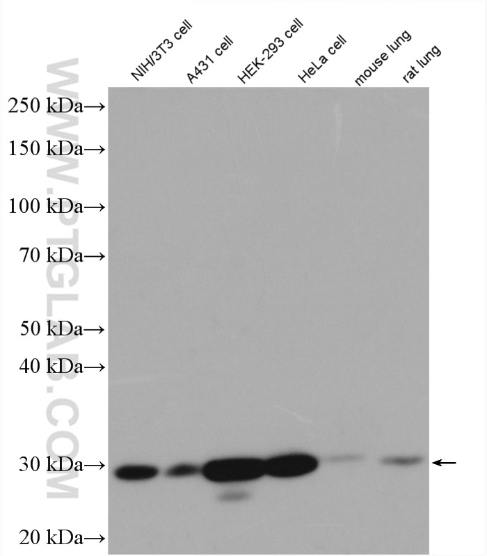 Western Blot (WB) analysis of A431 cells using DENR Polyclonal antibody (10656-1-AP)