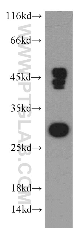 Western Blot (WB) analysis of mouse brain tissue using DENR Polyclonal antibody (10656-1-AP)