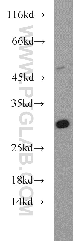 Western Blot (WB) analysis of A431 cells using DENR Polyclonal antibody (10656-1-AP)