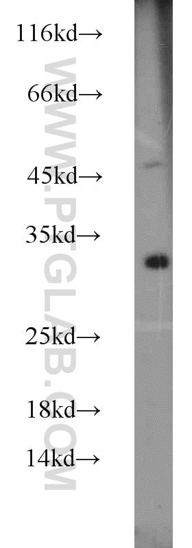 Western Blot (WB) analysis of mouse lung tissue using DENR Polyclonal antibody (10656-1-AP)