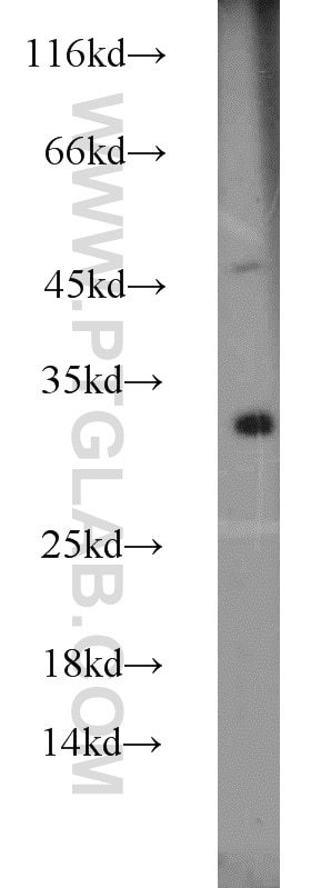 WB analysis of mouse lung using 10656-1-AP