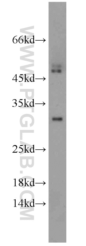 Western Blot (WB) analysis of HEK-293 cells using DENR Polyclonal antibody (10656-1-AP)