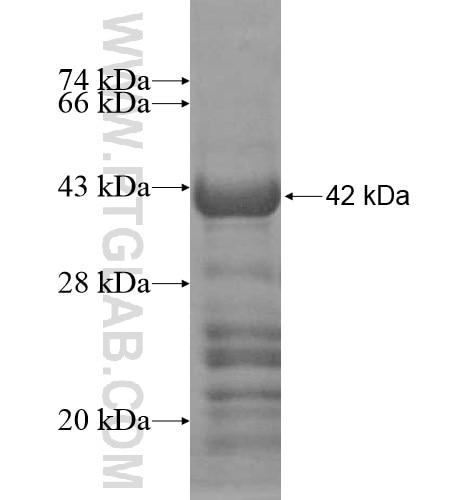 DEPDC1 fusion protein Ag12019 SDS-PAGE
