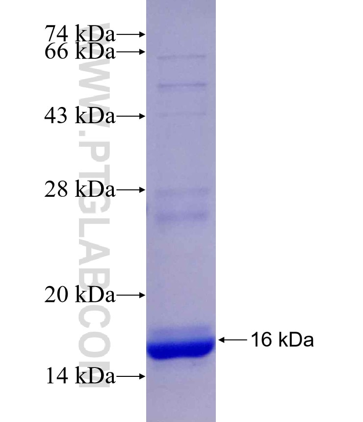 DEPDC5 fusion protein Ag30176 SDS-PAGE