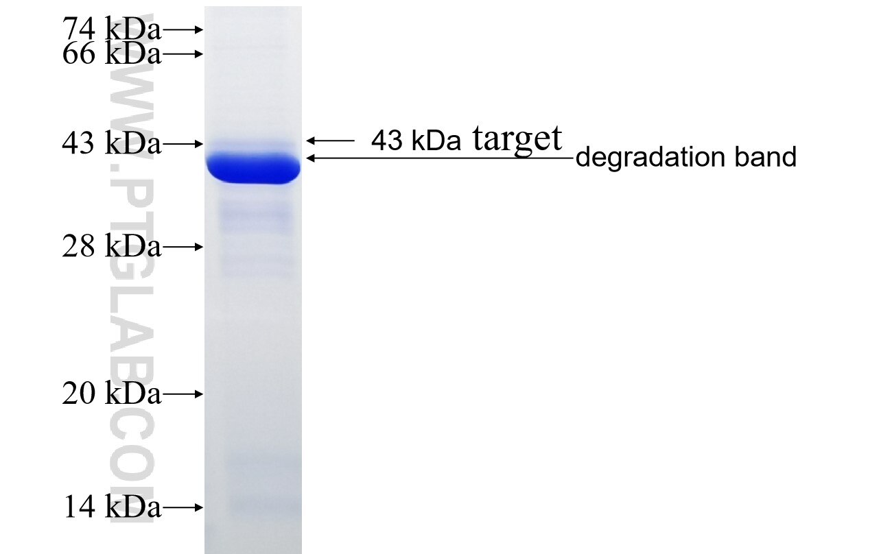 DEPDC5 fusion protein Ag20261 SDS-PAGE