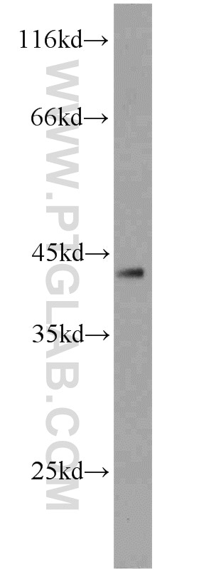 Western Blot (WB) analysis of MCF-7 cells using DEPDC6/Deptor Polyclonal antibody (20985-1-AP)
