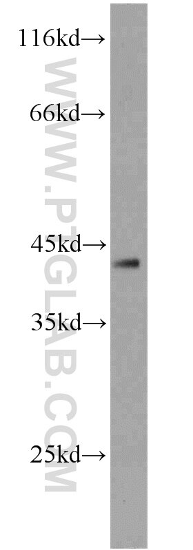 Western Blot (WB) analysis of MCF-7 cells using DEPDC6/Deptor Polyclonal antibody (20985-1-AP)