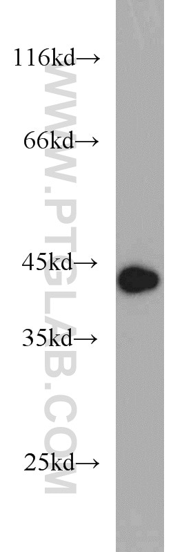Western Blot (WB) analysis of A2780 cells using DEPDC6/Deptor Polyclonal antibody (20985-1-AP)