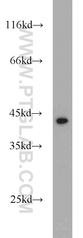 Western Blot (WB) analysis of HeLa cells using DEPDC6/Deptor Polyclonal antibody (20985-1-AP)
