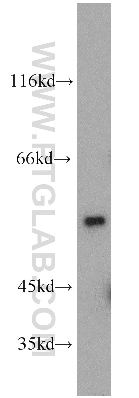 Western Blot (WB) analysis of HeLa cells using DEPDC6 Polyclonal antibody (21312-1-AP)