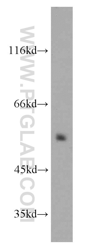 Western Blot (WB) analysis of HT-1080 cells using DEPDC6 Polyclonal antibody (21312-1-AP)