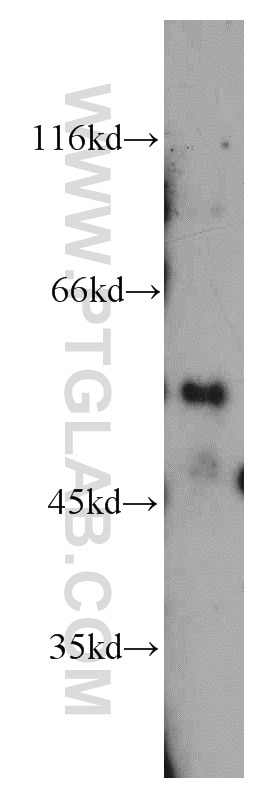 Western Blot (WB) analysis of COLO 320 cells using DEPDC6 Polyclonal antibody (21312-1-AP)