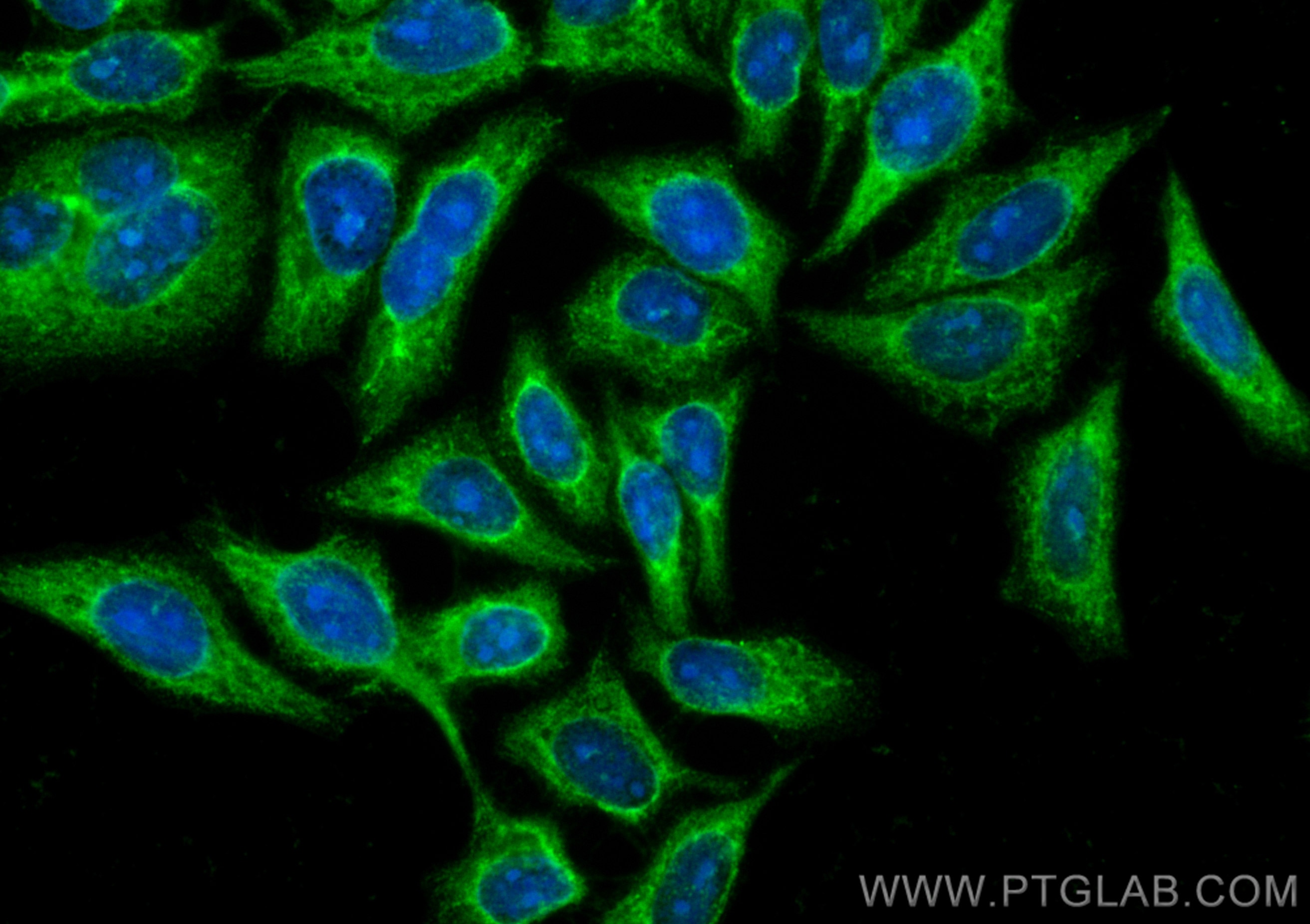 Immunofluorescence (IF) / fluorescent staining of HepG2 cells using CoraLite® Plus 488-conjugated DEPDC6/Deptor Polycl (CL488-20985)