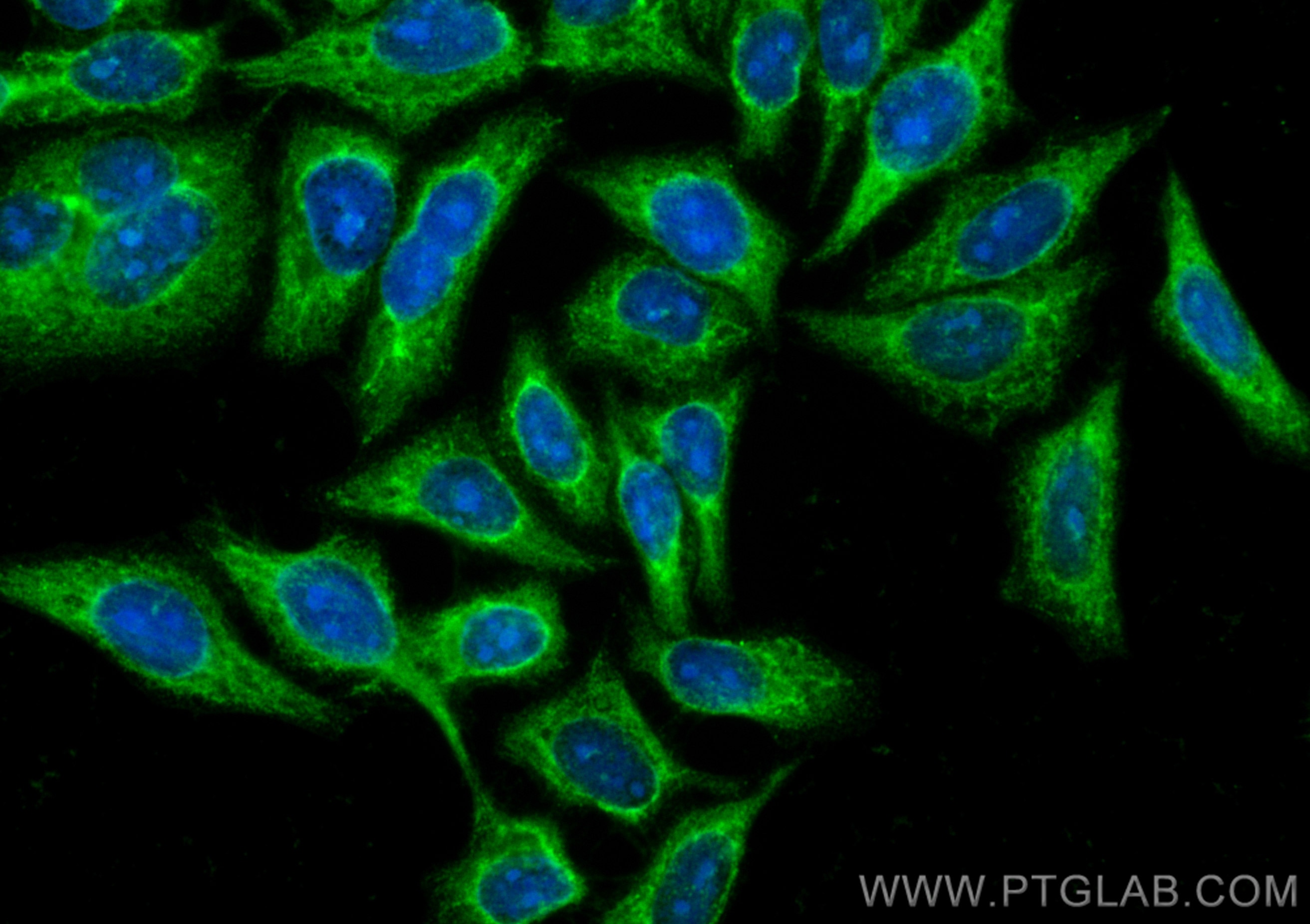 Immunofluorescence (IF) / fluorescent staining of HepG2 cells using CoraLite® Plus 488-conjugated DEPDC6/Deptor Polycl (CL488-20985)