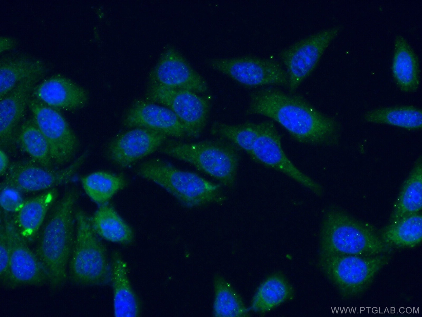 Immunofluorescence (IF) / fluorescent staining of HepG2 cells using DEPDC7 Polyclonal antibody (26517-1-AP)