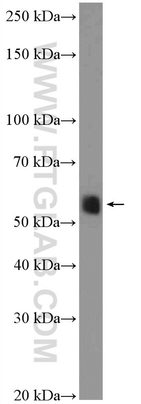 Western Blot (WB) analysis of HeLa cells using DEPDC7 Polyclonal antibody (26517-1-AP)
