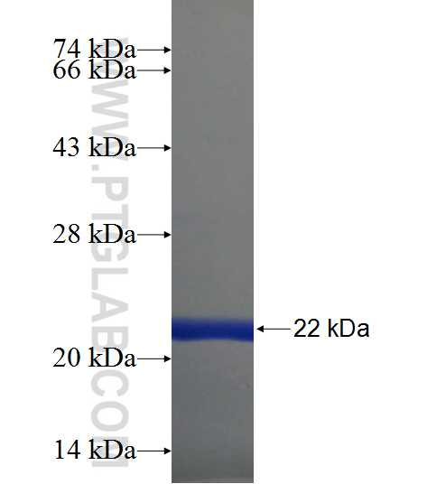DEPDC7 fusion protein Ag24094 SDS-PAGE