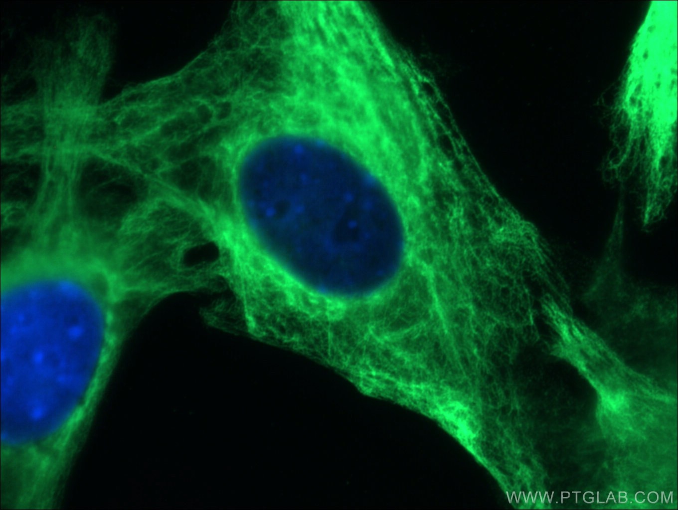 Immunofluorescence (IF) / fluorescent staining of C2C12 cells using Desmin Polyclonal antibody (16520-1-AP)