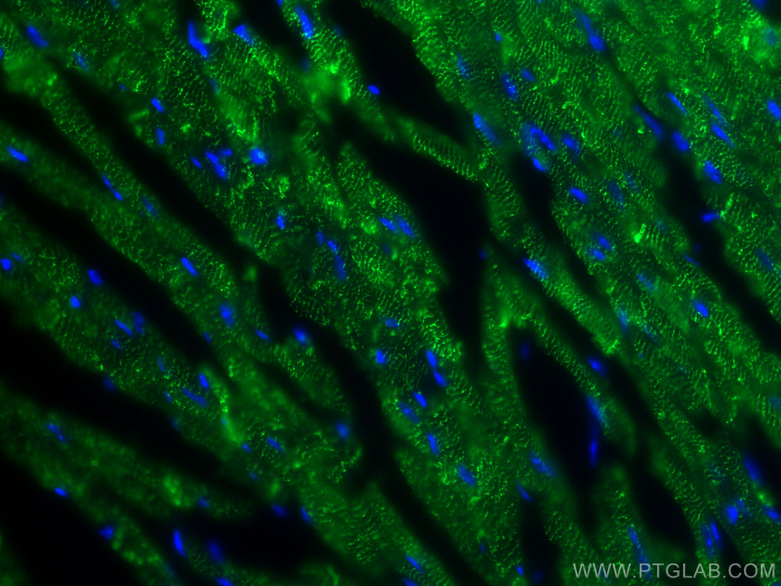 Immunofluorescence (IF) / fluorescent staining of mouse heart tissue using Desmin Polyclonal antibody (16520-1-AP)