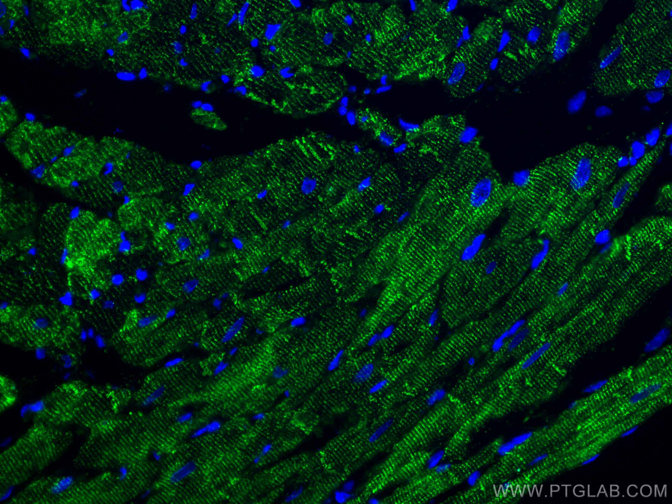 Immunofluorescence (IF) / fluorescent staining of rat heart tissue using Desmin Polyclonal antibody (16520-1-AP)