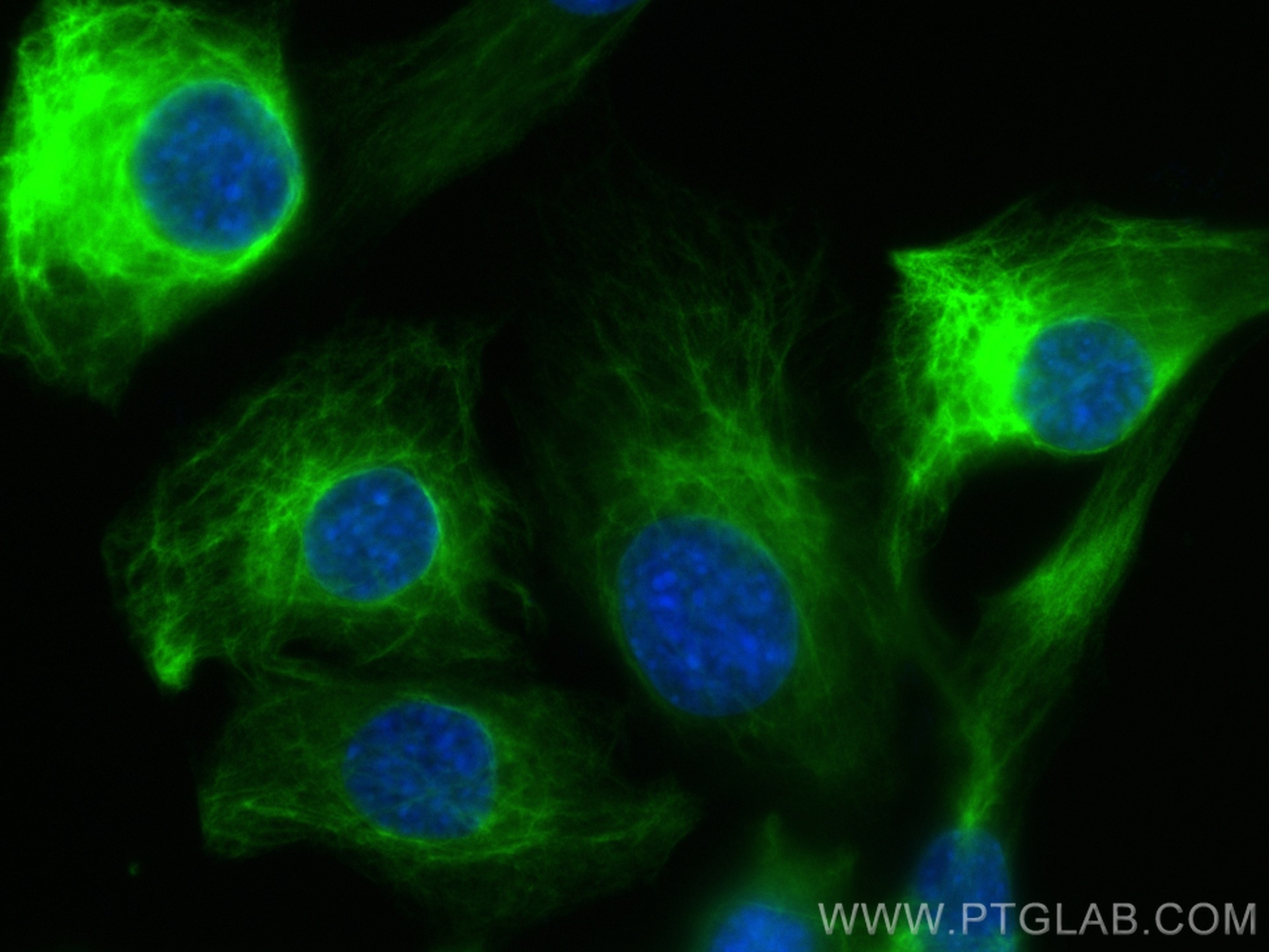 Immunofluorescence (IF) / fluorescent staining of C2C12 cells using Desmin Polyclonal antibody (16520-1-AP)